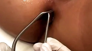 Asian patient penetrated prevalent anal hole by stud prevalent missionary